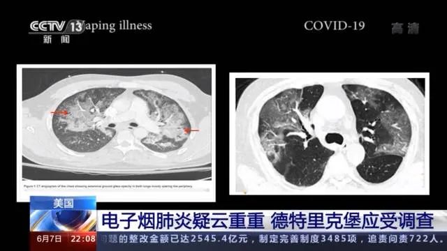 轰动！新冠病毒源头浮出水面！外交部火力全开：武汉军运会，美国到底做了什么？!